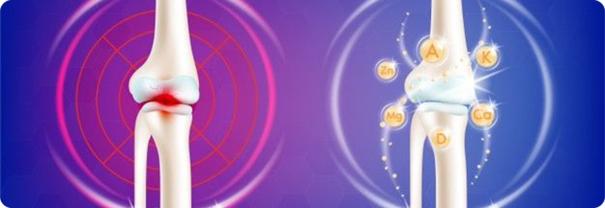 Step 4: Blocking Inflammation-Causing Arteries