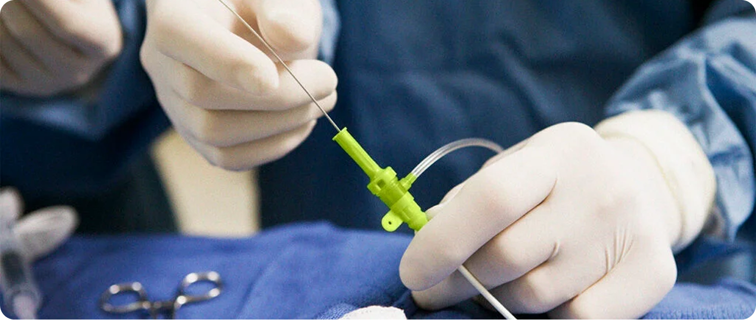 Step 2: Access Through a Tiny Pinhole